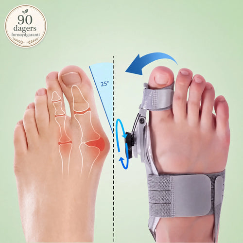 TåKorrekt™ – Skånsom justering og smertelindring for hallux valgus