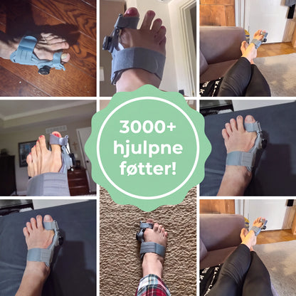 TåKorrekt™ – Skånsom justering og smertelindring for hallux valgus